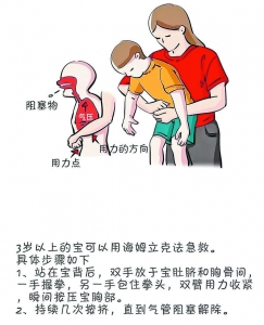异物卡喉后应该怎么做？