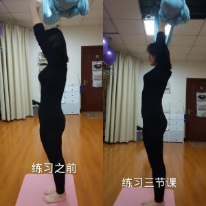 润瑜伽培训结合中医调理还你一个完美身材